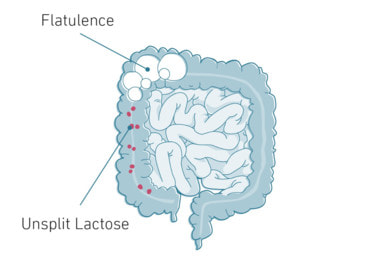 Enzymes for lactose intolerance